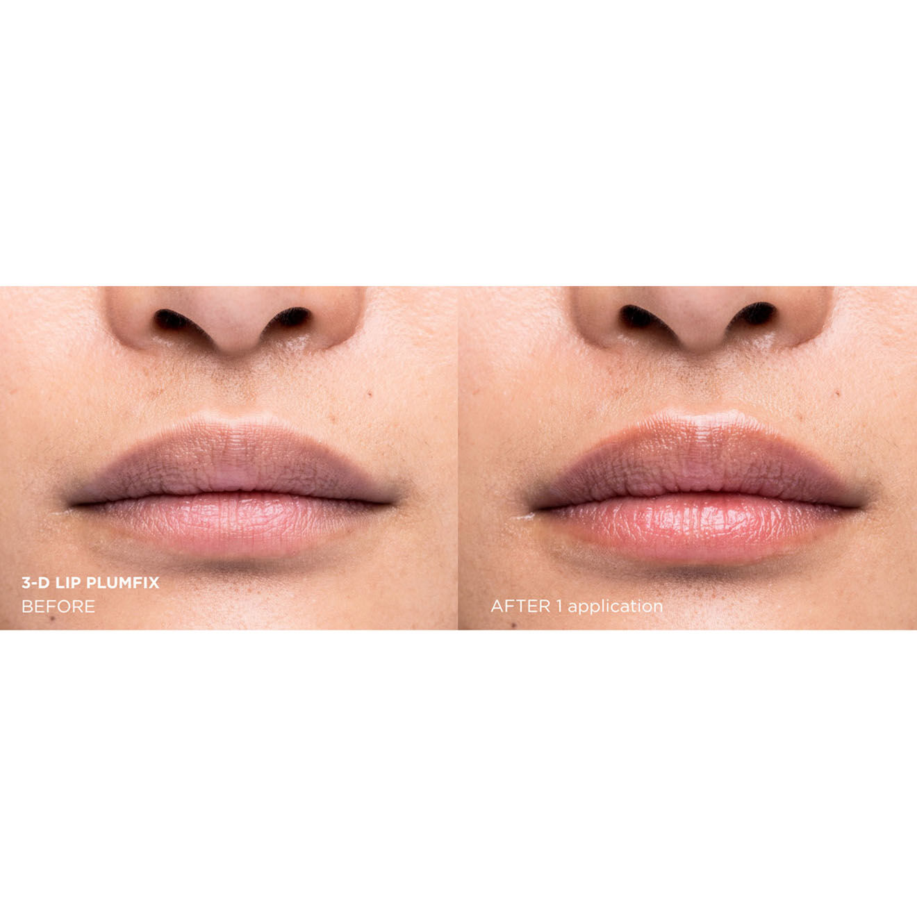 Dr. Brandt Plumpfix 3D Repulpant et hydratant Lèvres Needles no More - 5g
