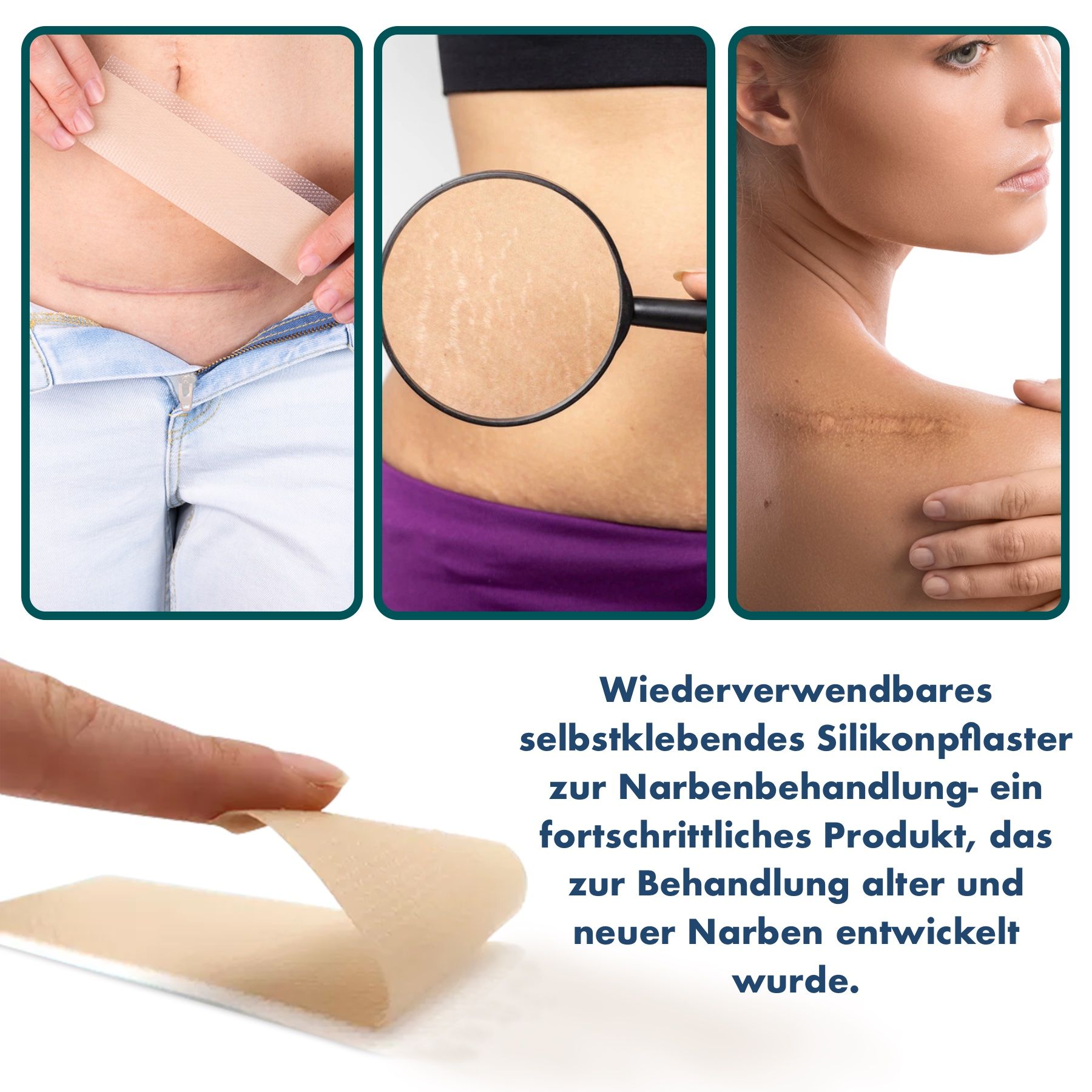 P-Beauty Wundpflaster für Narben