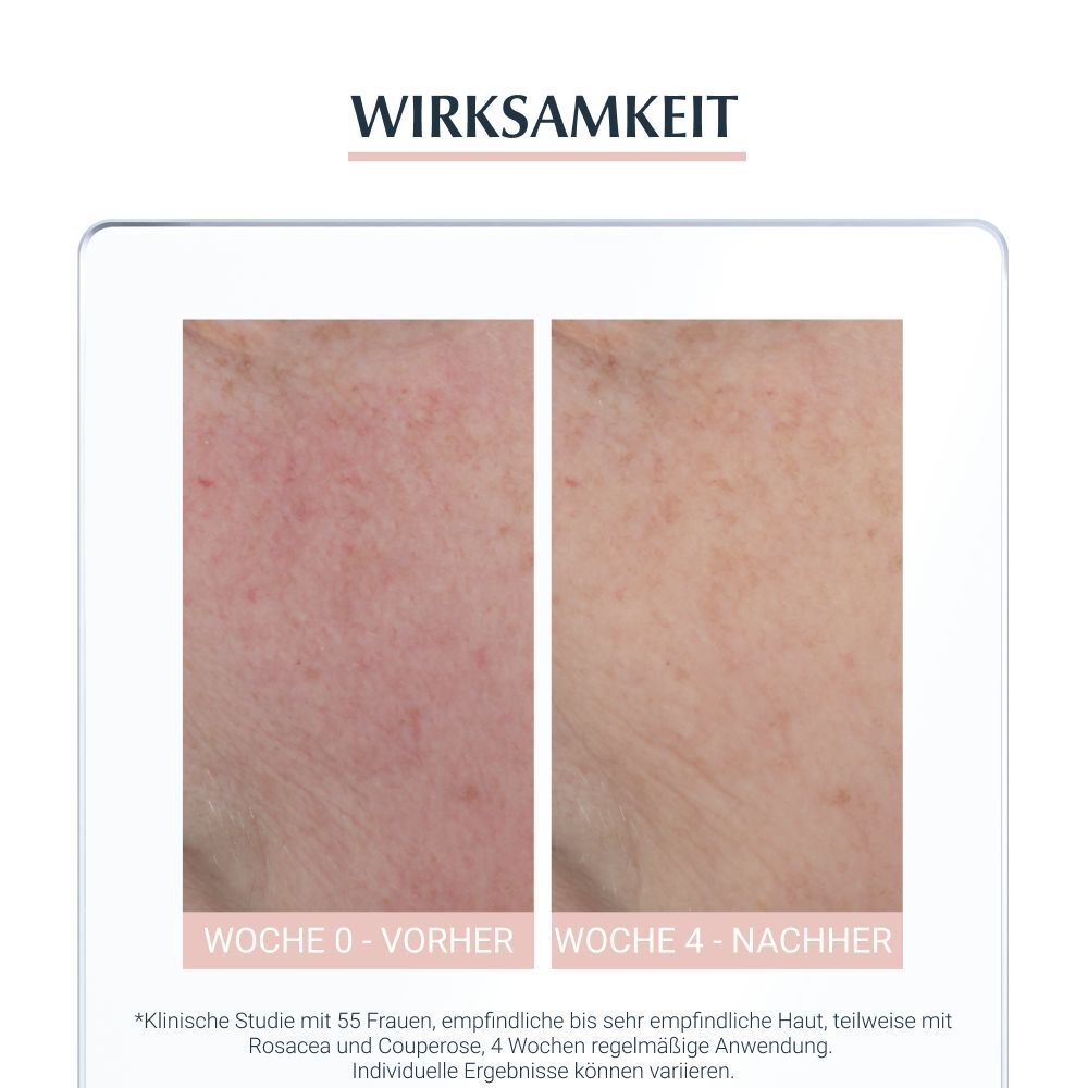 Eucerin® AntiRötungen Beruhigende Pflege – für sehr empfindliche und gerötete Haut & zur Behandlung der Eigenschaften von sehr empfindlicher Haut