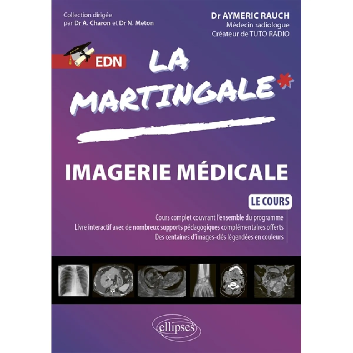La martingale. Imagerie médicale : le cours : EDN