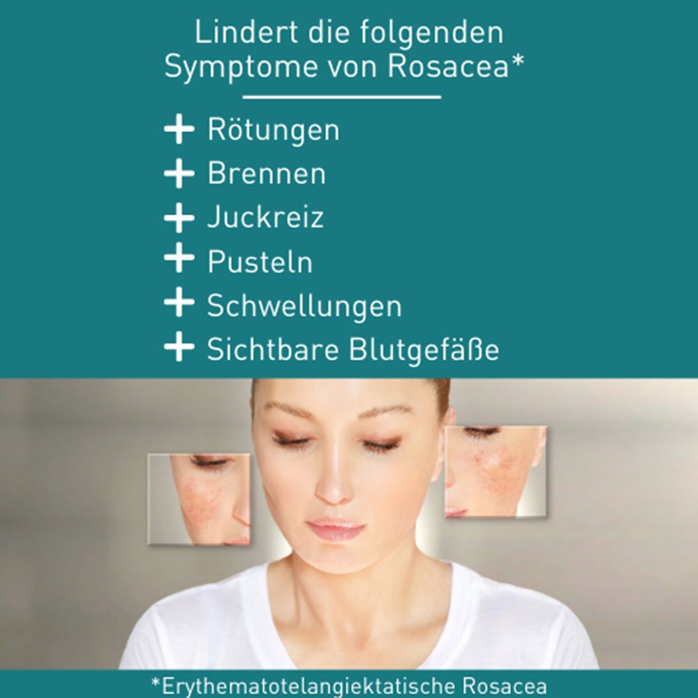 N1 Rosacea Crème – beruhigt und lindert Rötungen und Juckreiz