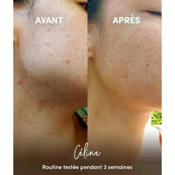 Waam Nettoyant Anti-imperfections en Poudre 40g