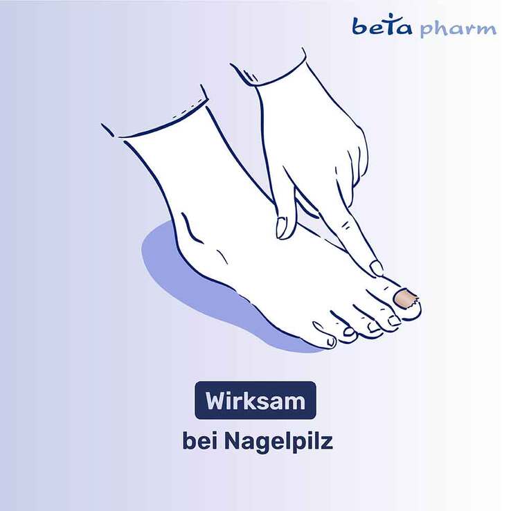 Amorolfin beta 50 mg/ml wirkstoffhaltiger Nagellack, 5 ml
