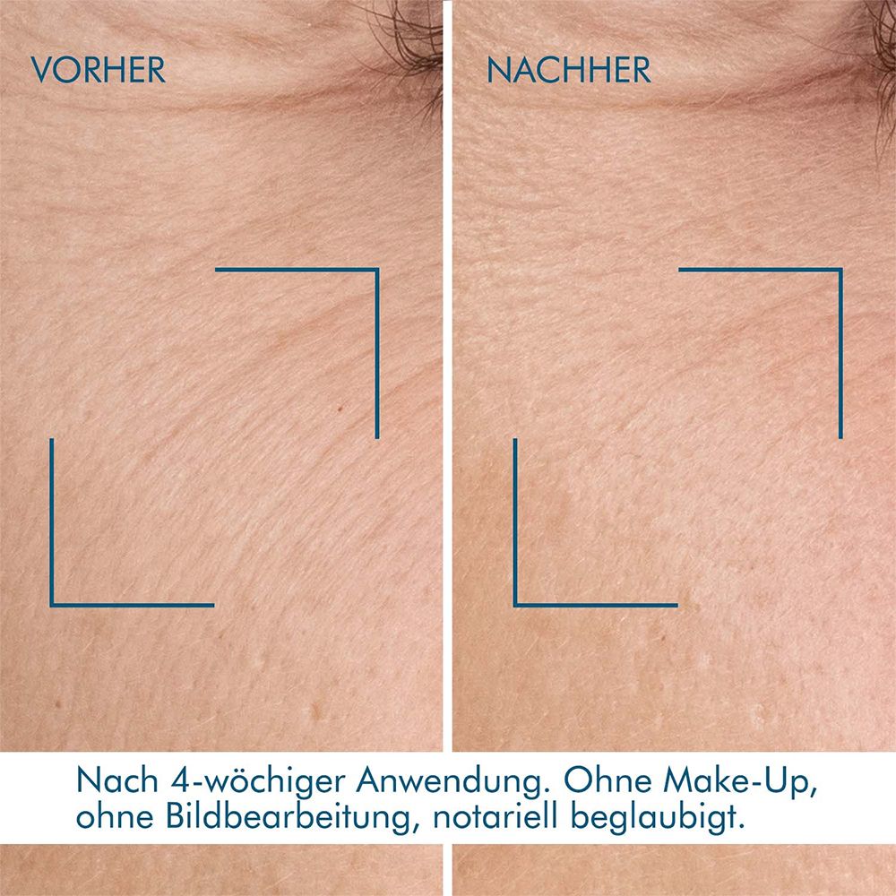 BIOTHERM Blue Retinol Nachtserum - Jetzt 20% sparen mit Code 
