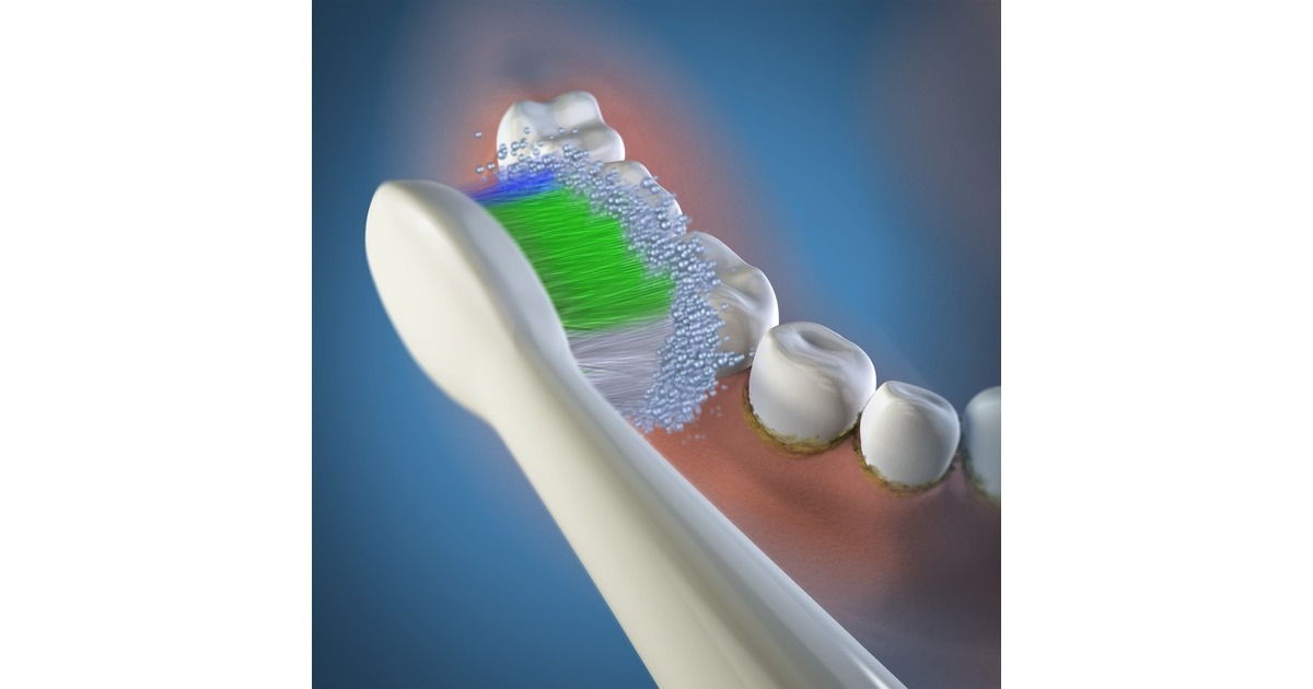 WaterpikSRSB-3E Opzetborstels Small voor Sensonic tandenborstel  (3 stuks)
