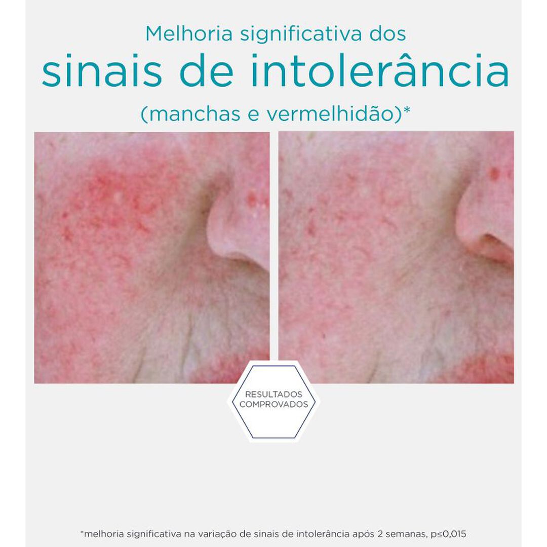 NEOSTRATA  Restore - Sérum Anti-envelhecimento e Anti-vermelhidão - 29gr
