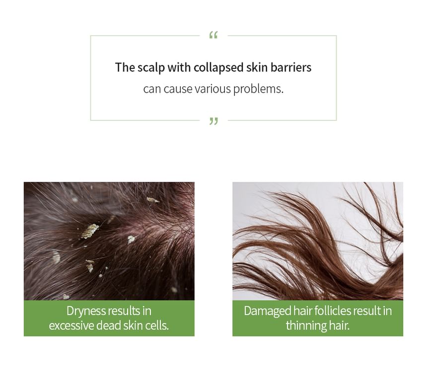 MASIL - 5 Probiotica Appelazijn Shampoo
