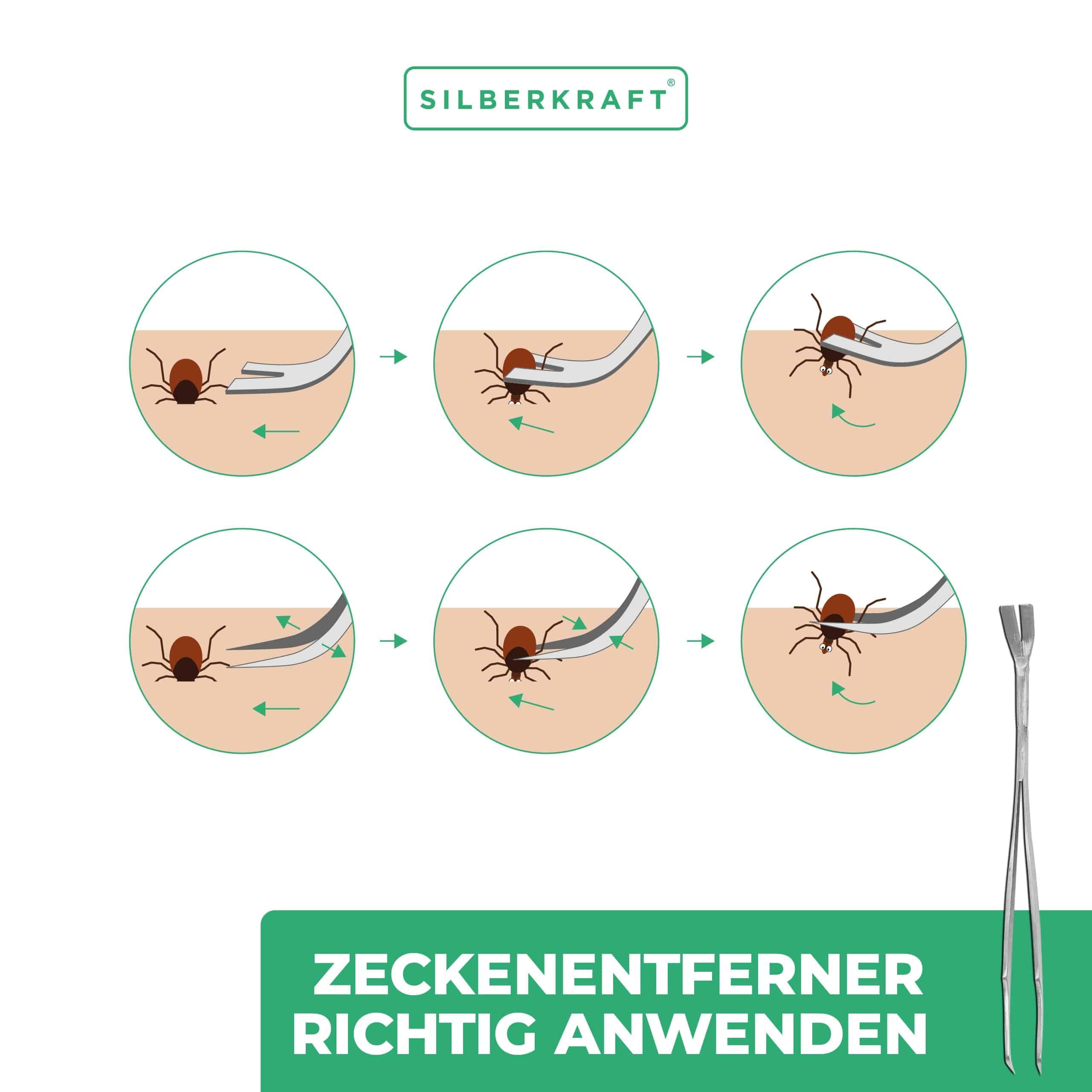 SILBERKRAFT Zeckenzange
