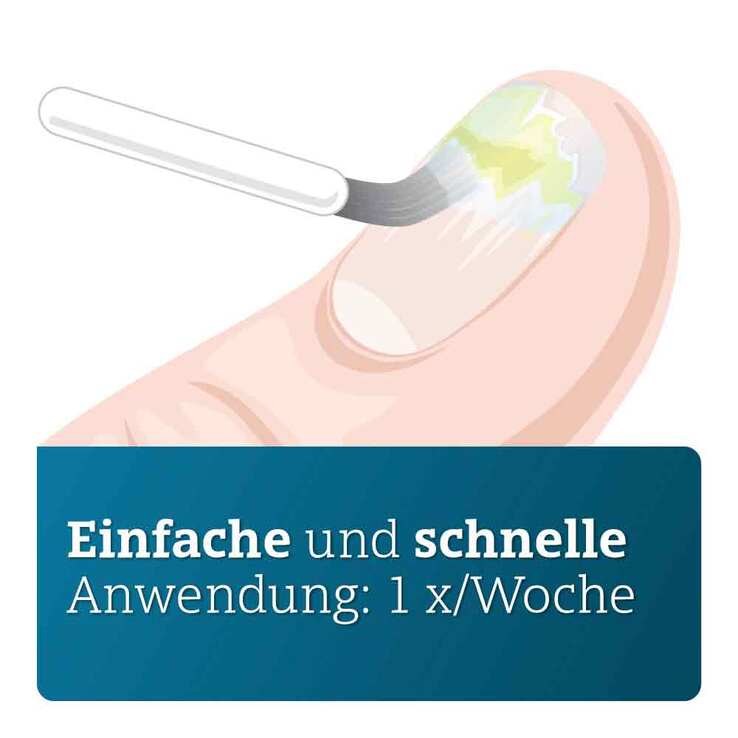 Amorolfin ADGC 50 mg / ml wirkstoffhalt.Nagellack, 5 ml