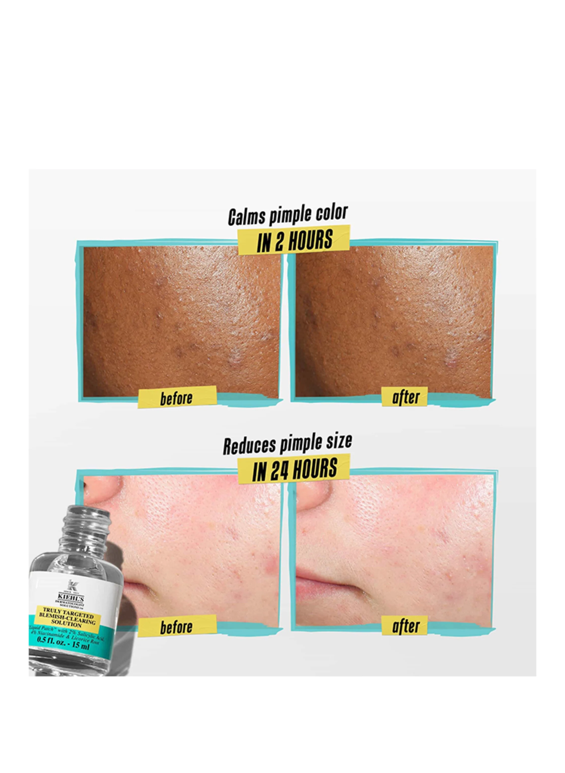 Kiehl's TRULY TARGETED BLEMISH CLEARING SOLUTION