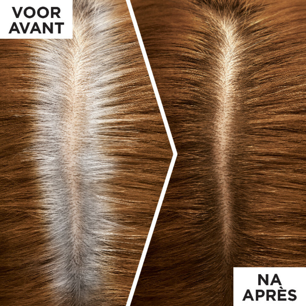 L'Oréal Magic Retouch Uitgroeispray Goud Middenbruin75 ml