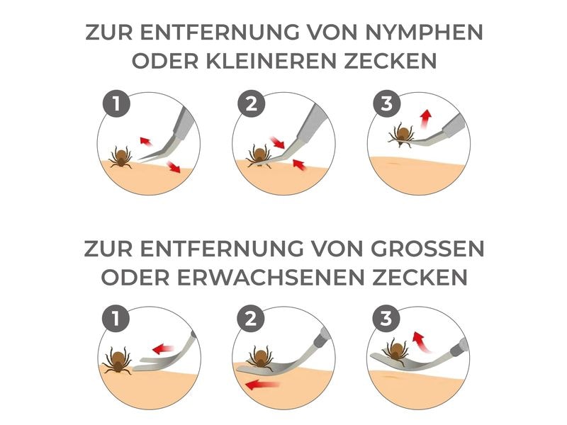 Quick Aid 2 in 1 Zeckenentferner mit Etui 1 Stück Profi-Zeckenentferner mit 2-in1-Funktion