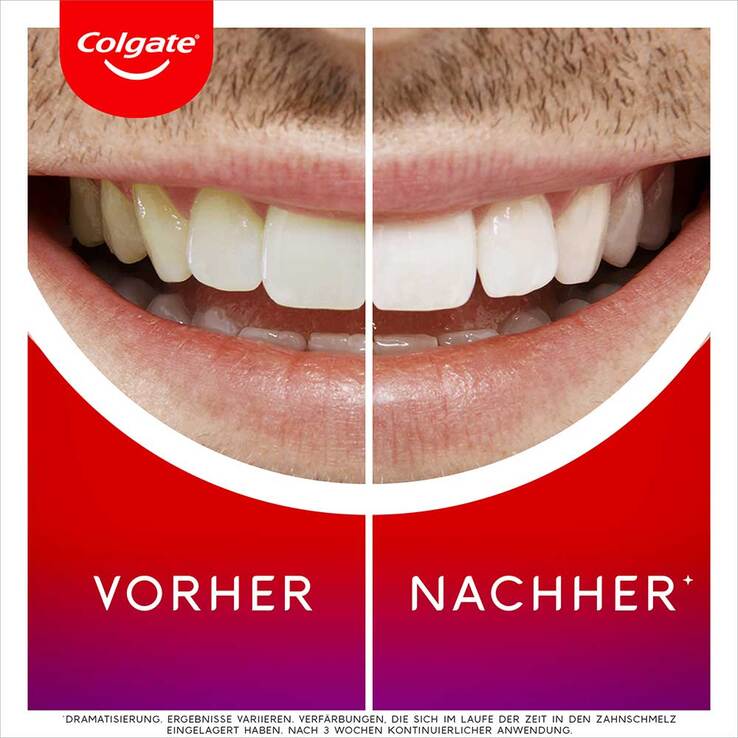 Colgate Max white Overnight whitening Serum, 2.5 ml