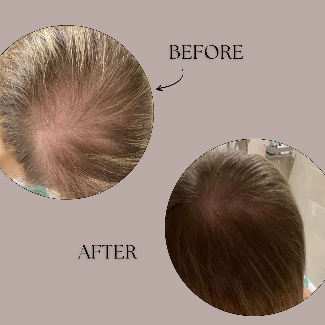 genuine haircare -  Balance Scalp Lotion