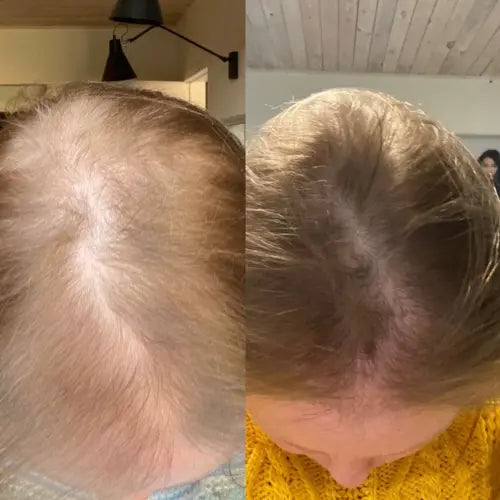 Hydrolyzed Collagen & Vitamin C