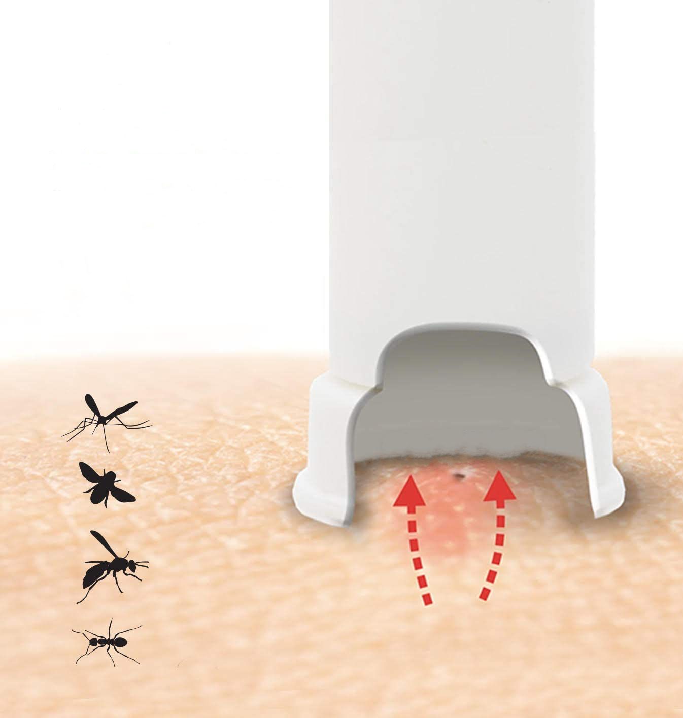 Bug Bite Thing® - Gegen Mückenstiche, Bienen, Wespen & Insekten. Sofortige Linderung | Schwarz