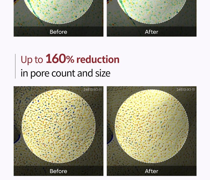 Dr.Melaxin - Peel Shot Exfoliant Zwarte Rijst Ampul