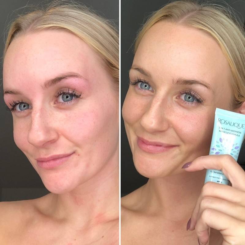 Rosalique 3-In-1 Anti-Redness Miracle Formula SPF 50 - 30 ml