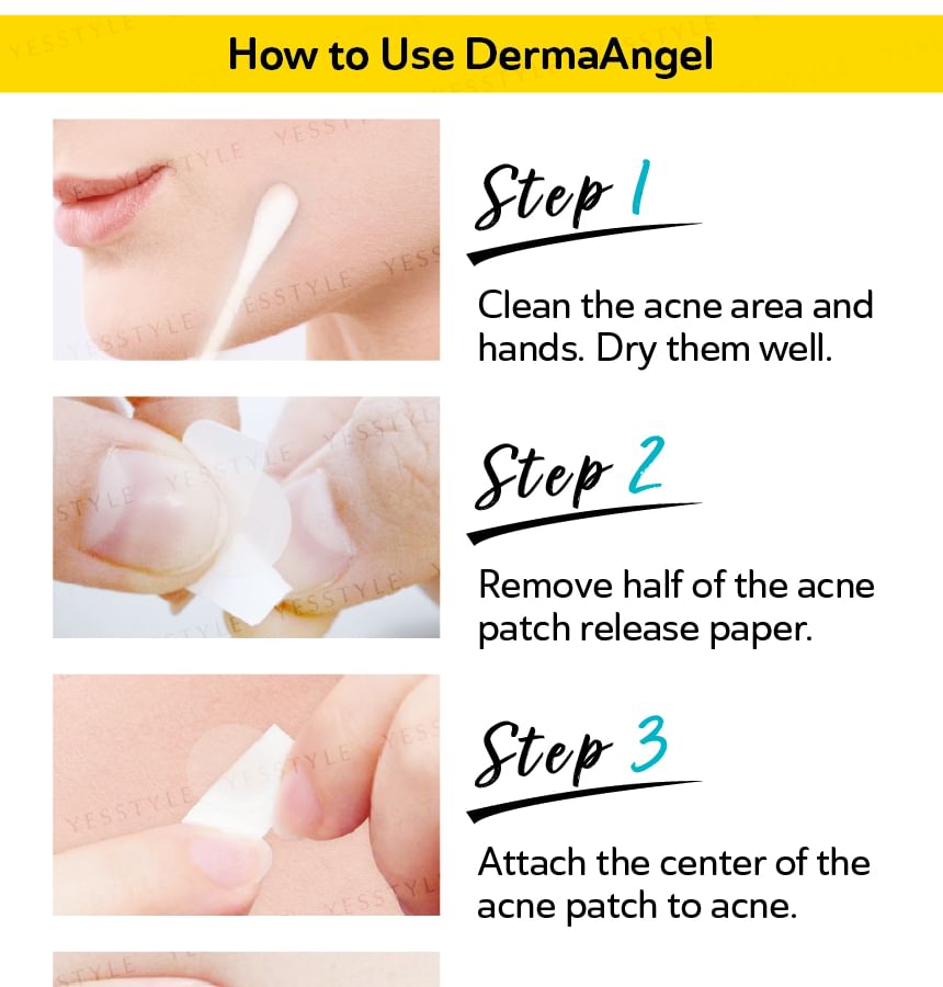 DermaAngel - Dagpleister tegen acne, 24 stuks
