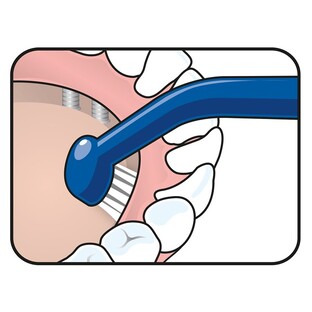 TePe Universal Care - Speciale Tandenborstel 1ST
