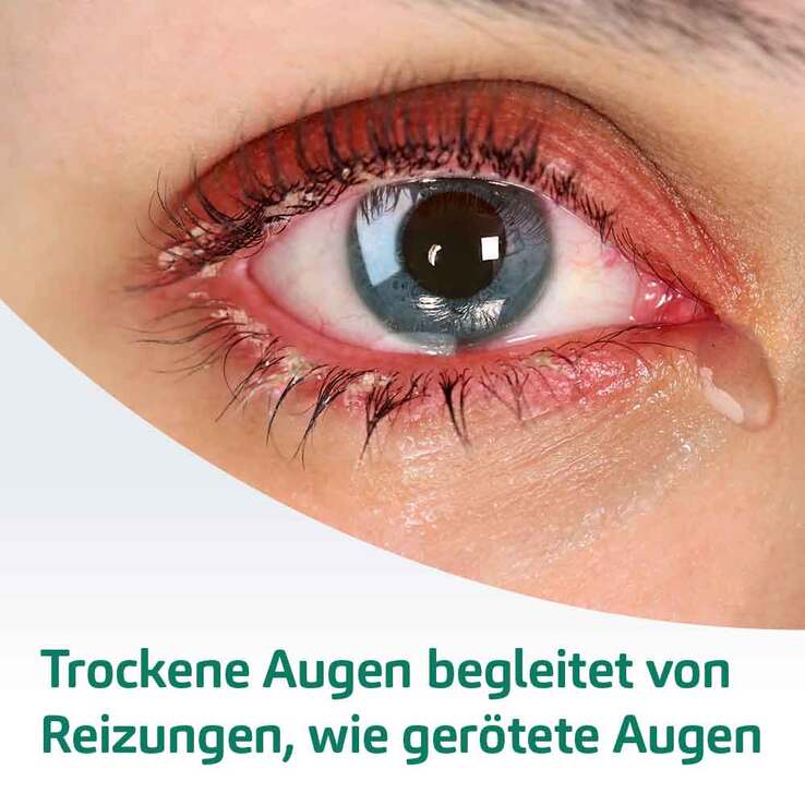 EvoTears® OMEGA Augentropfen, 3 ml