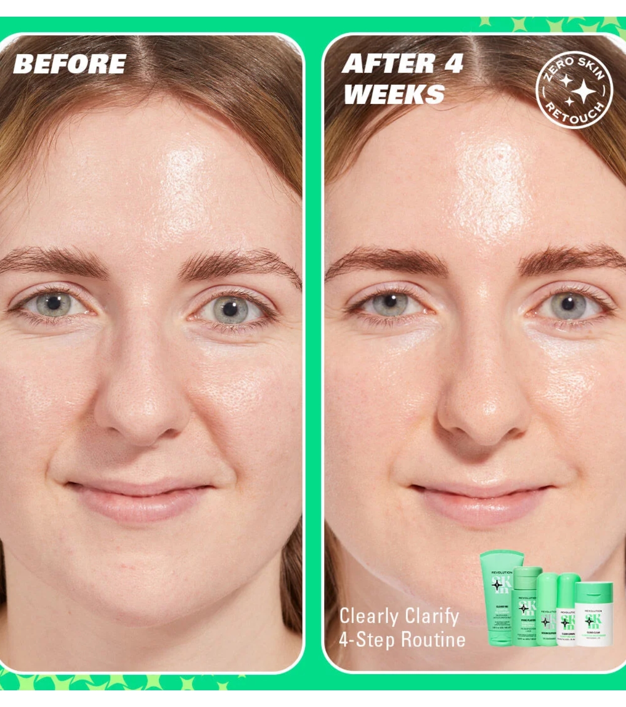 Revolution Skin - *Clearly Clarify* - Sérum facial clareador com 5% de niacinamida e 2% de ácido salicílico Clear Canvas