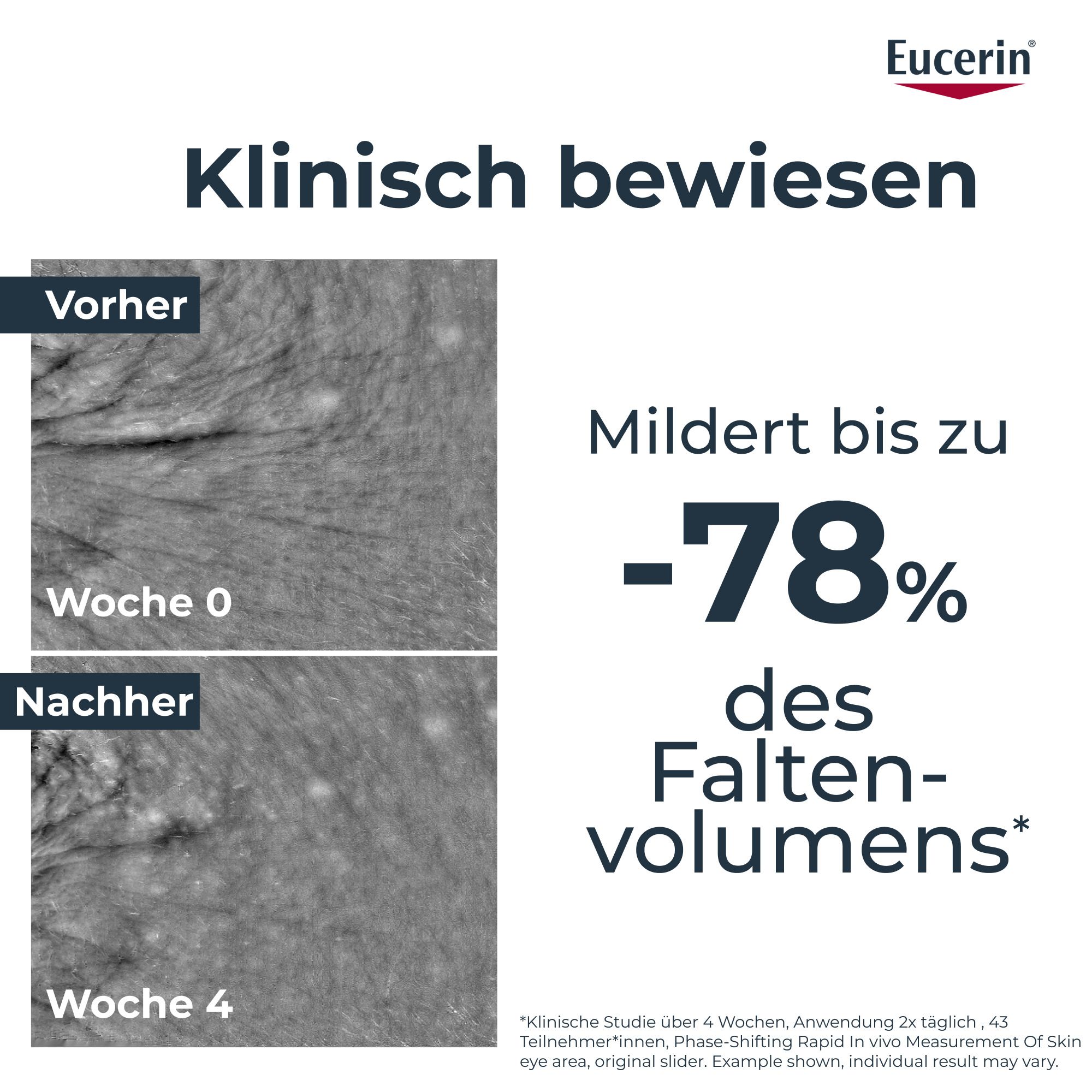Eucerin® Hyaluron-Filler Epigenetic Serum – Anti-Age Serum für jünger aussehende Haut