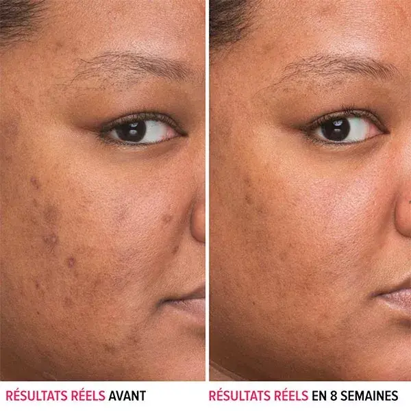 Sérum Facial IT Cosmetics Bye Bye Dark Spots Anti-Manchas com Niacinamida 30ml