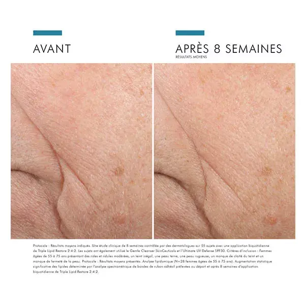 Skinceuticals Triple Lipid Restore 2:4:2 Tratamento Facial Antienvelhecimento Repositor de Lipídios e Suavizante 48ml