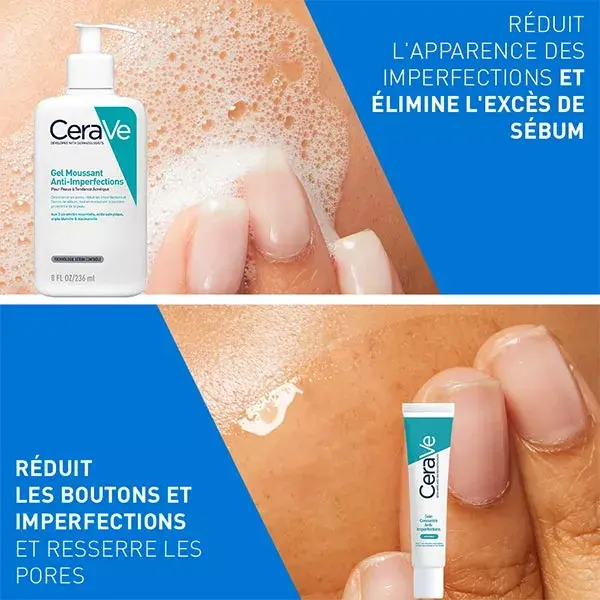 Rotina CeraVe Anti-Acne: Gel Espumante Anti-Acne 236ml e Concentrado Anti-Acne 40ml