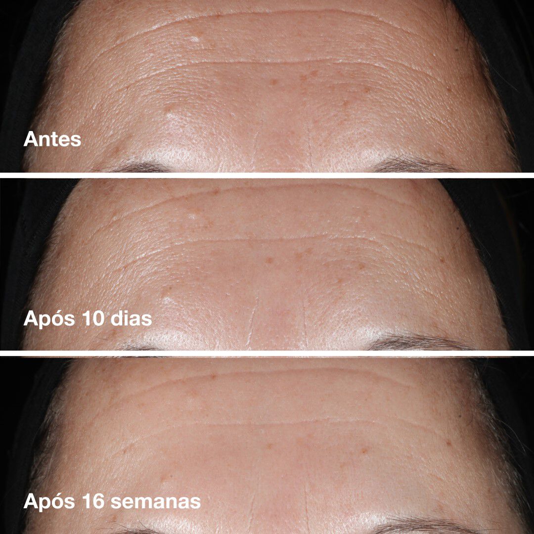 CLINIQUE Smart Clinique Smart Clinical Repair™ Wrinkle Correcting Serum - 30ml