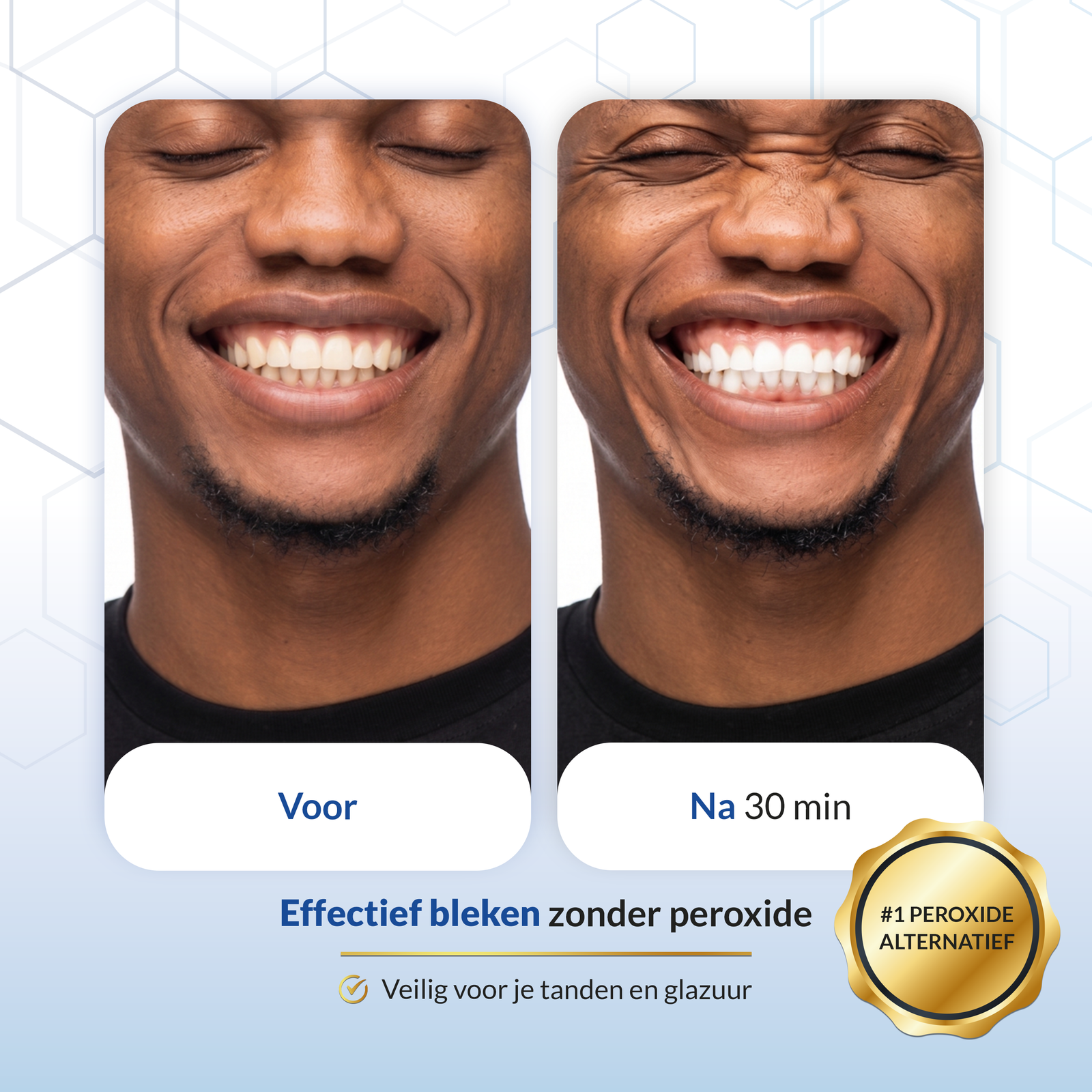 Pro-LED Teeth Whitening Set