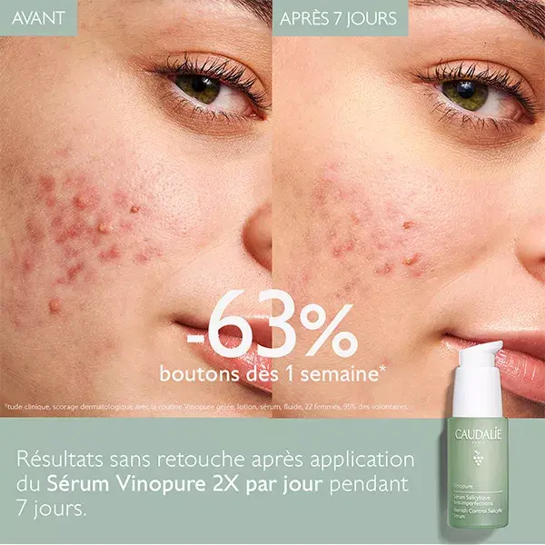 Sérum Anti-Imperfeições com Ácido Salicílico Vinopure da Caudalie 30ml