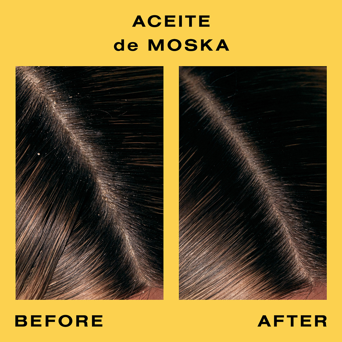 Aceite de Moska Scalp Oil 60ml