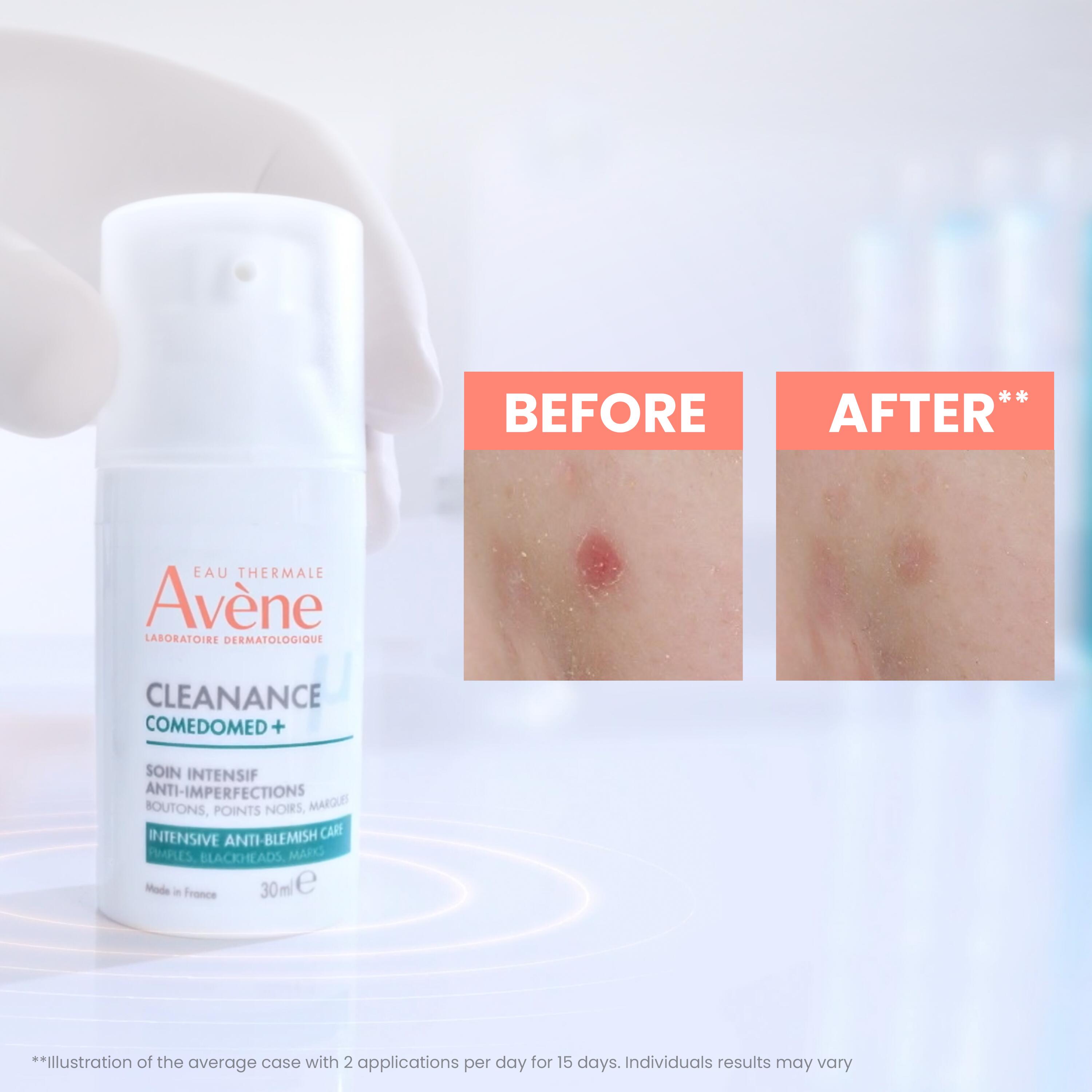AVENE Cleanance Comedomed+<br>30 ml, Flasche, Konzentrat, intensiv Konzentrat