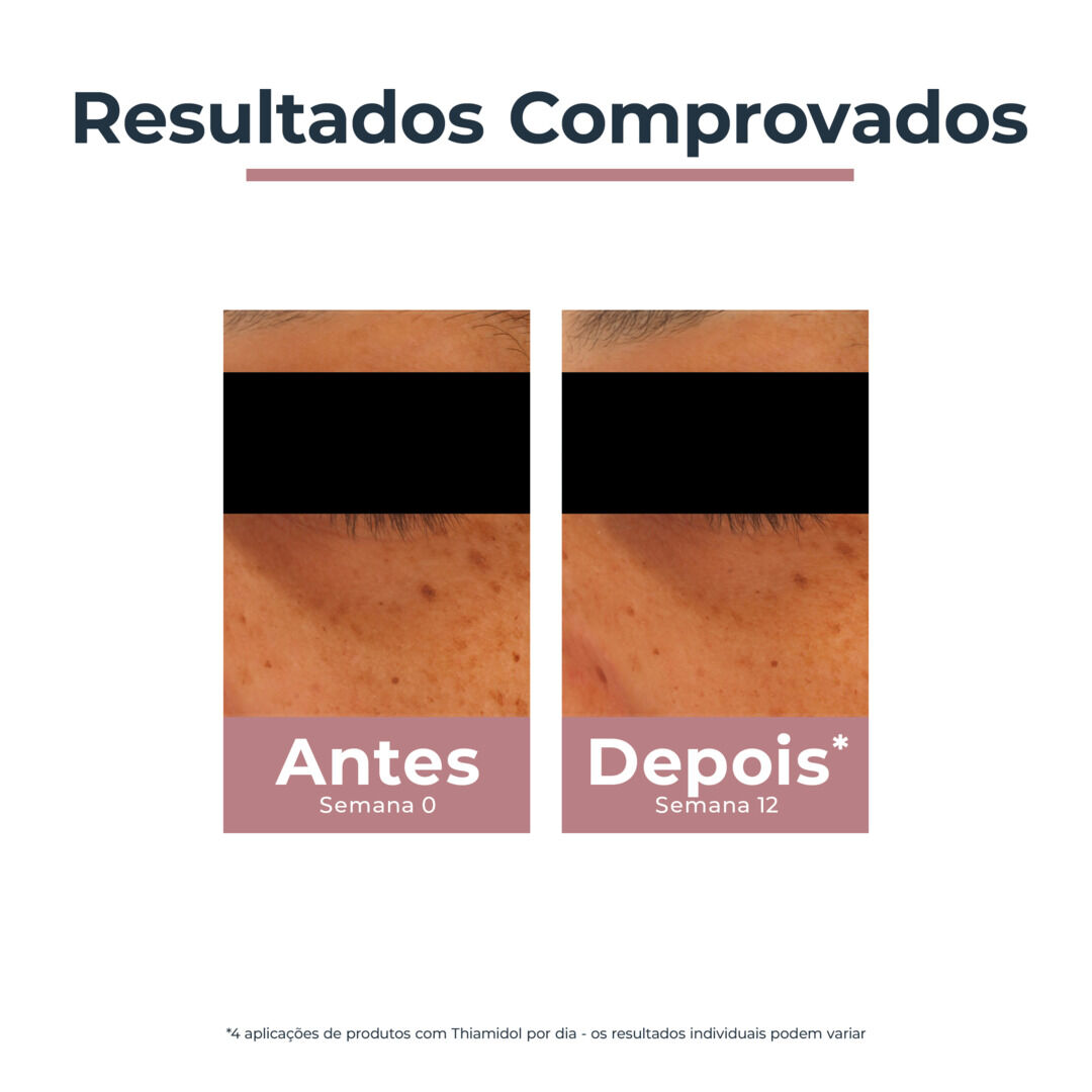 EUCERIN  Anti-Pigment Contorno de Olhos Iluminador Antiolheiras - 15ml