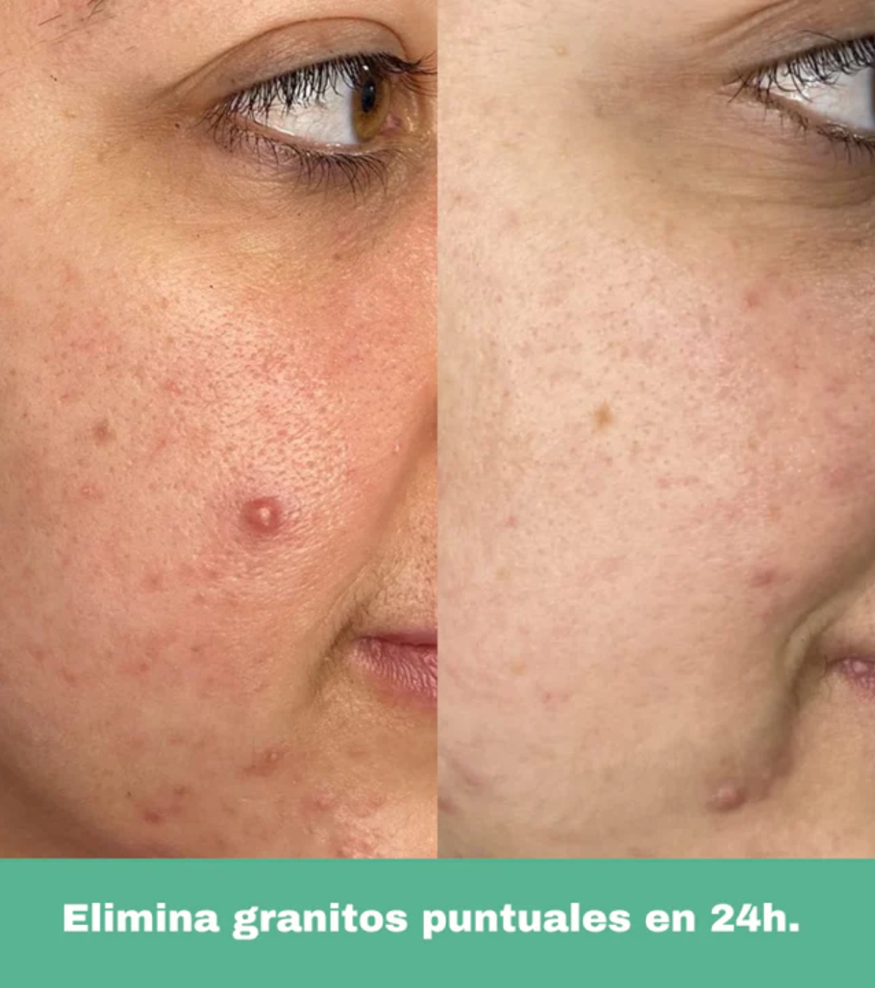 CR Cosmetics - *Purifying* - Roll-on anti-manchas
