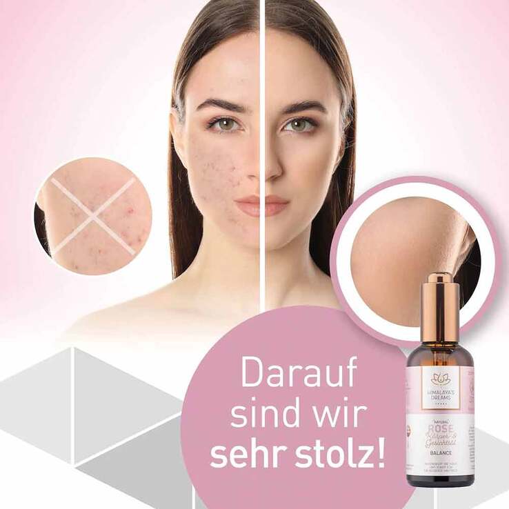 Himalayas Dreams Ayurveda Körper & Gesichtsöl Rose, 100 ml