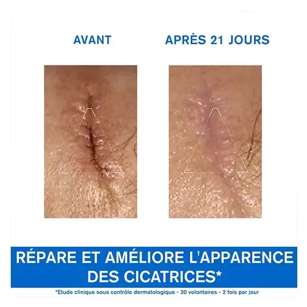 Uriage Bariéderm-Cica Creme Reparador de Cobre e Zinco para Pele Danificada 100 ml