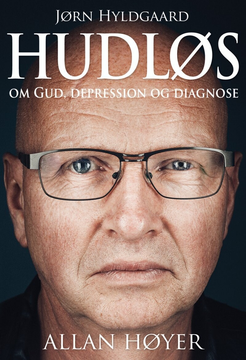Hudløs - Allan Høyer - Bog