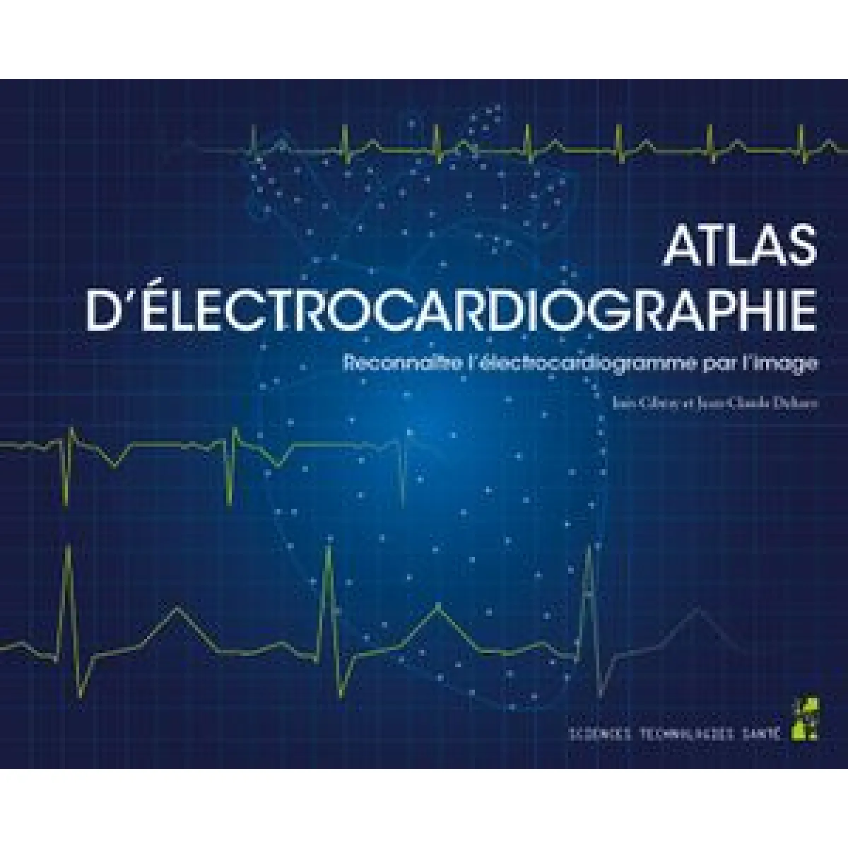 Atlas d'électrocardiographie : reconnaître l'électrocardiogramme par l'image