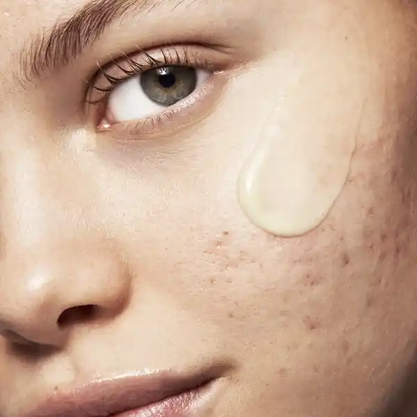 Blemish Breakthrough Blemish Control Basics Kit