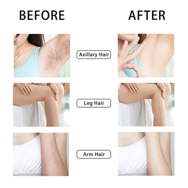 UNIQ Crystal Hair Eraser - Epilator med krystall for Smertefri hårfjerning - Gull