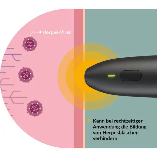 Lippen-Herpes Wärmestift