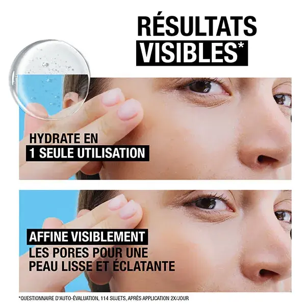 Neutrogena Hydro Boost Serum 10% Niacinamida 30ml frasco conta-gotas