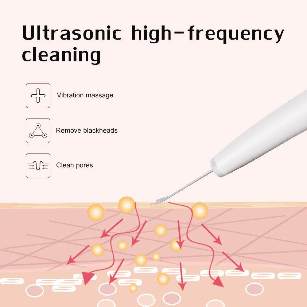 Ultraschall Peeling Hautreiniger Porenreiniger Haut Scrubber (30.000 Schwingungen/Sek) - Weiss