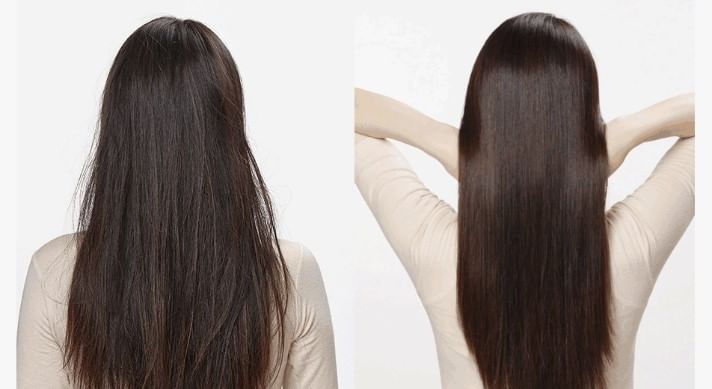 Dr.FORHAIR - UNOVE Diepe Schade Behandeling EX Mini - 2 Types