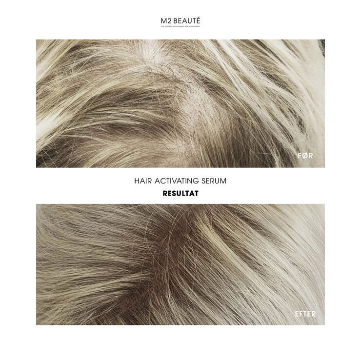 M2 Beauté Hair Activating Serum
