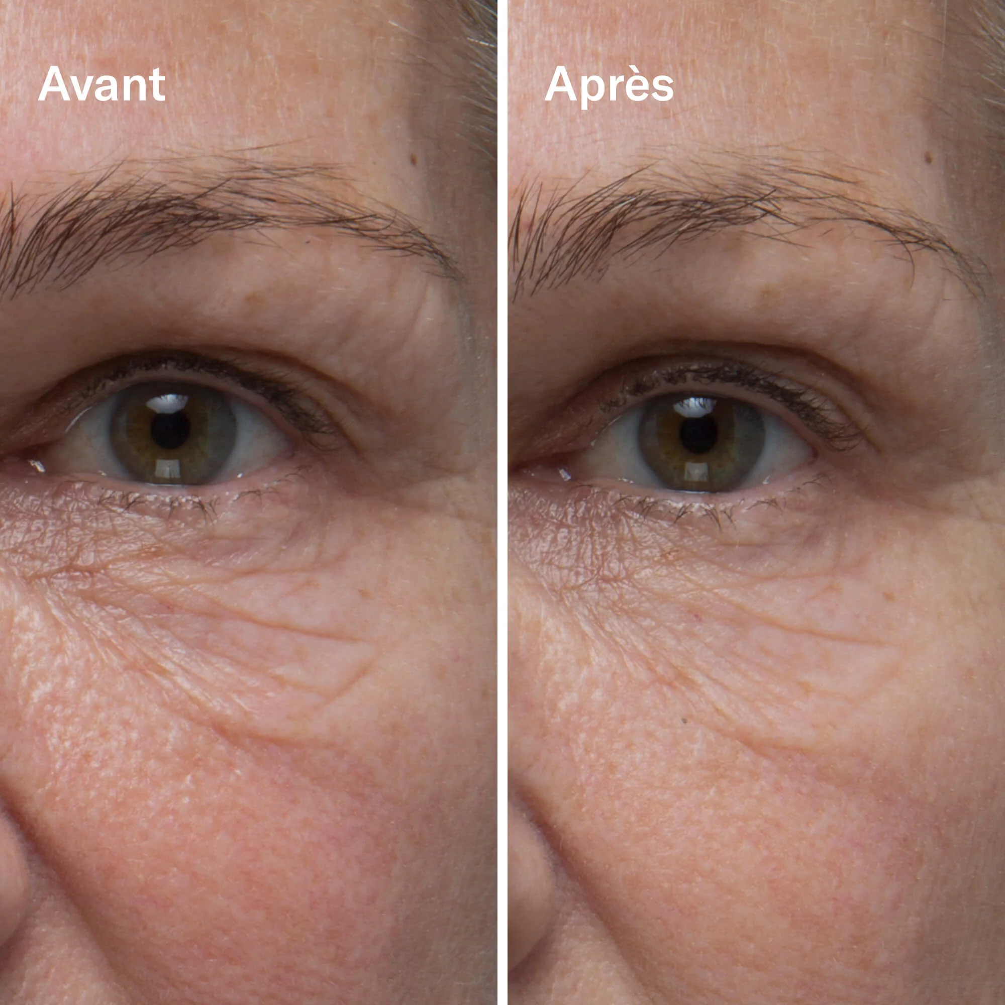 Odacité Clean-ical Renewing Serum Sérum Rénovant
