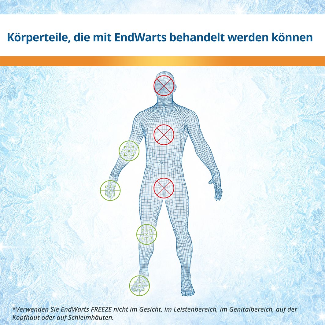 EndWarts FREEZE: Vereisungsmittel zur Entfernung von Warzen an Händen, Armen & Füßen